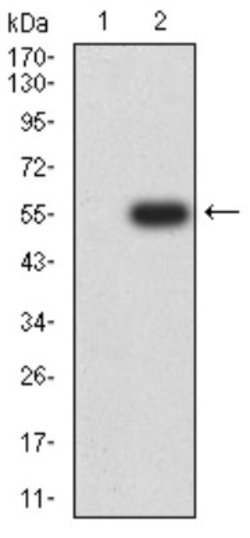 Nicotinic Acetylcholine R alpha 6/CHRNA6 Antibody (5B6G8) - BSA Free, Novus Biologicals 0.025 mL | Buy Online | Novus Biologicals | Fisher Scientific